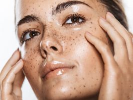 От старческих пятен до хлоазмы: какой бывает пигментация и как ее предотвратить