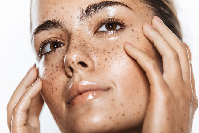 От старческих пятен до хлоазмы: какой бывает пигментация и как ее предотвратить