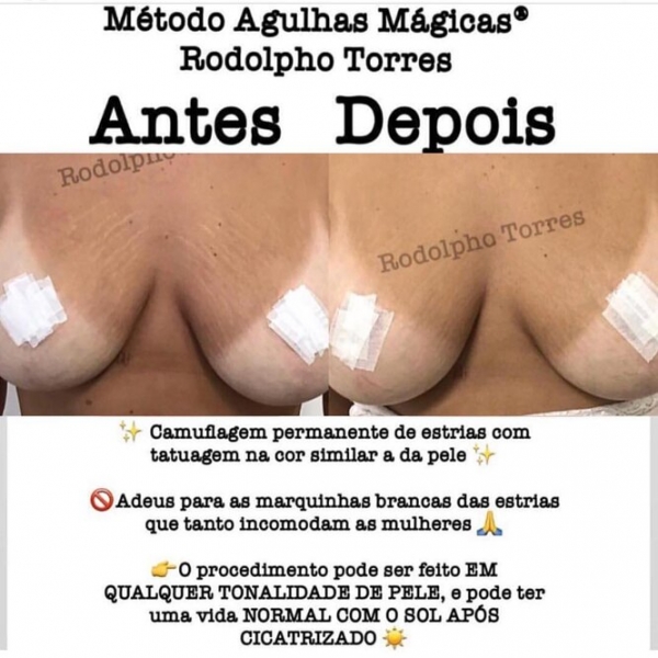 Странная мода: «трещина» на прессе, пирсинг пальца и другие модификации тела