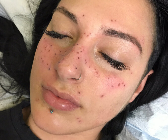 Странная мода: «трещина» на прессе, пирсинг пальца и другие модификации тела