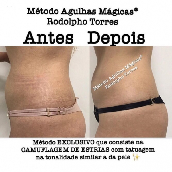 Странная мода: «трещина» на прессе, пирсинг пальца и другие модификации тела