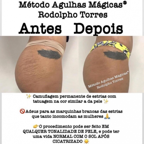 Странная мода: «трещина» на прессе, пирсинг пальца и другие модификации тела