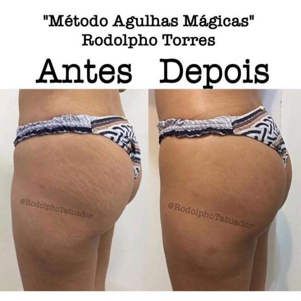 Странная мода: «трещина» на прессе, пирсинг пальца и другие модификации тела