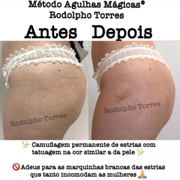 Странная мода: «трещина» на прессе, пирсинг пальца и другие модификации тела