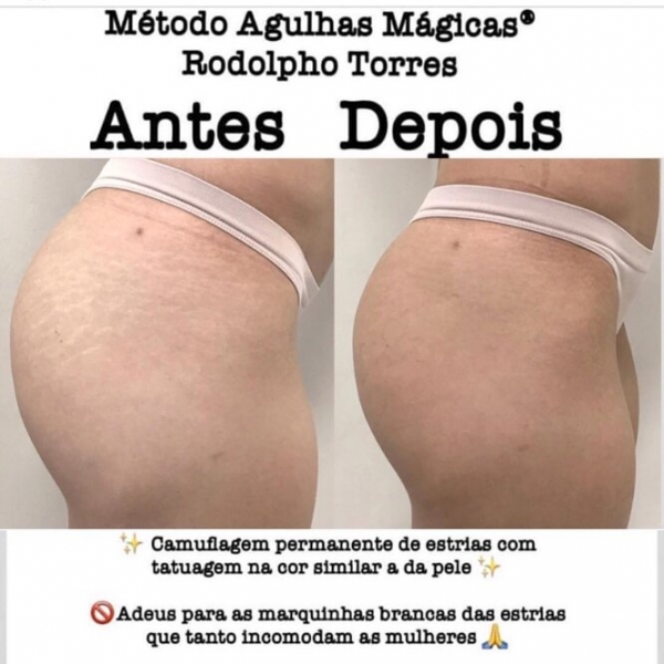 Странная мода: «трещина» на прессе, пирсинг пальца и другие модификации тела