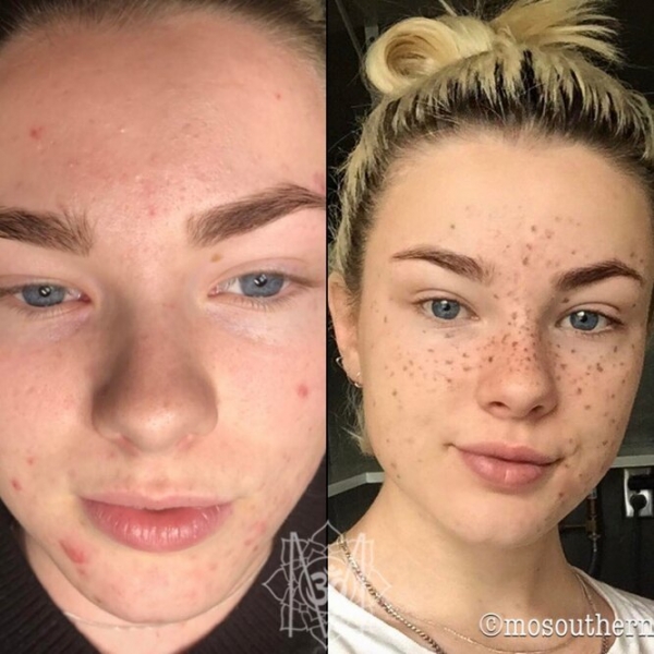 Странная мода: «трещина» на прессе, пирсинг пальца и другие модификации тела