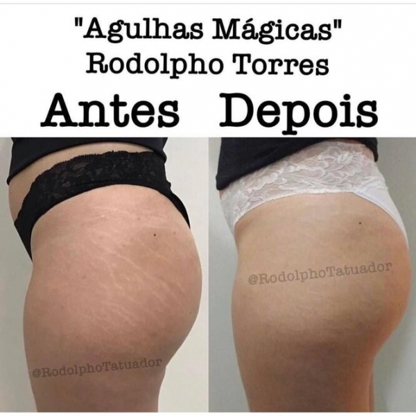 Странная мода: «трещина» на прессе, пирсинг пальца и другие модификации тела