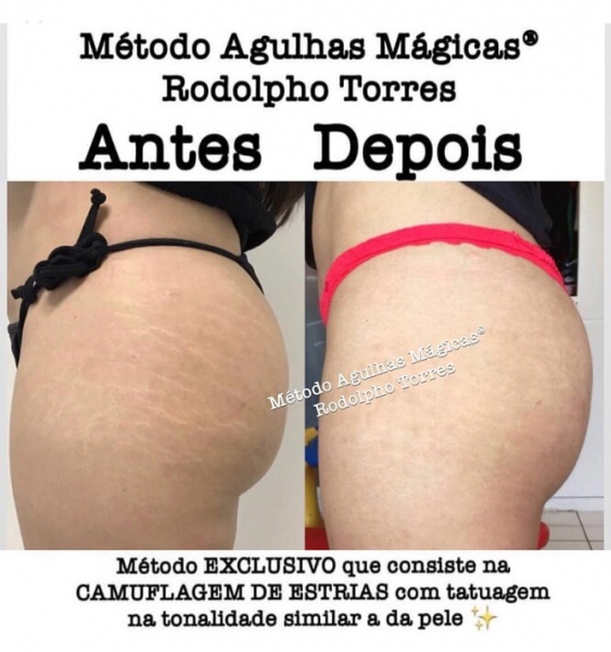 Странная мода: «трещина» на прессе, пирсинг пальца и другие модификации тела