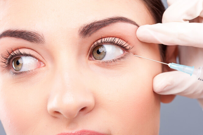 Уколы в веки, чтобы увеличить глаза: чем опасен безумный бьюти-тренд из Кореи