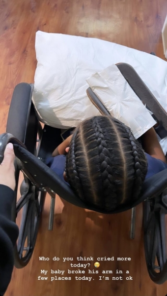 «Ты по-настоящему сломан»: Канье Уэст испугал подписчиков снимком рентгена