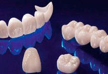 Металлокерамическая и керамическая коронка: преимущества и показания к установке