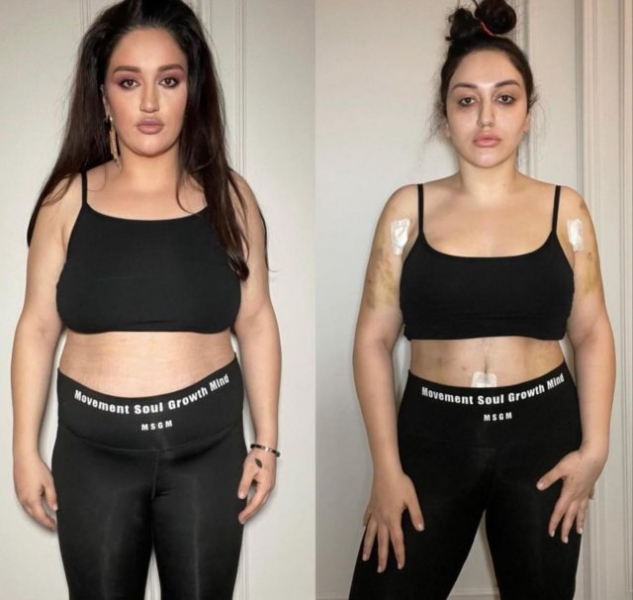 Гоар Аветисян показала результат после пластических операций 