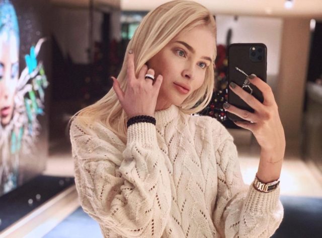 Алена Шишкова ответила на обвинения в пластике 