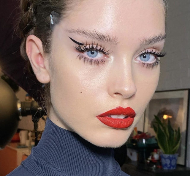 Тренд в пластике: что такое «подтяжка манекенщицы»