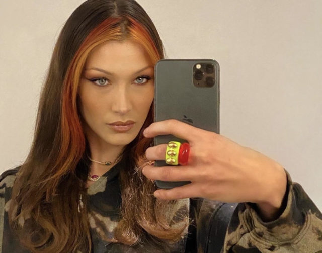 Тренд в пластике: что такое «подтяжка манекенщицы»