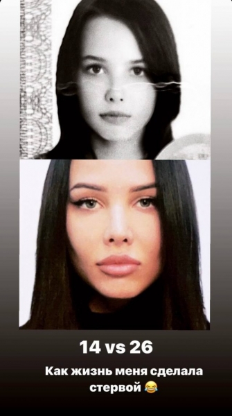 Как Анастасия Решетова выглядела до популярности