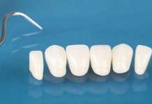 Композитные виниры: показания и противопоказания