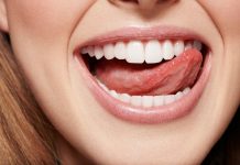 Что такое имплантация зубов