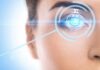 Когда и кому нужна лазерная коррекция зрения
