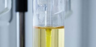 Почему вывод из запоя лучше проводить в стационаре