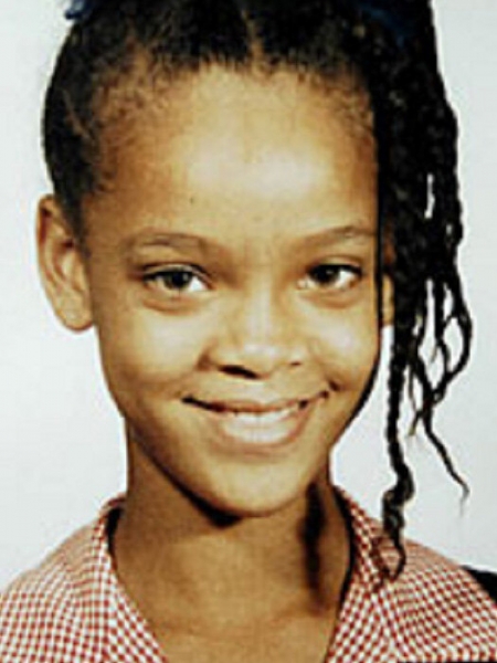 Больше не Чебурашки: звезды, сделавшие отопластику