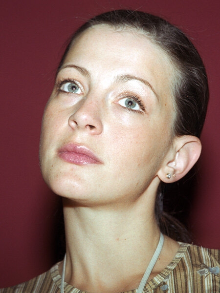 Больше не Чебурашки: звезды, сделавшие отопластику