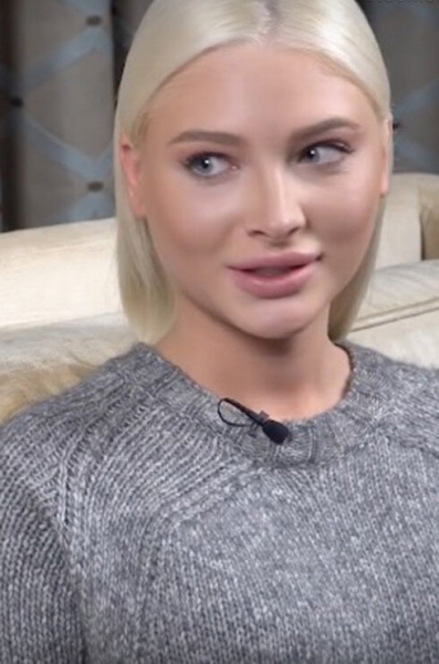 Instagram vs реальность: звезды с&nbsp;&laquo;щечками&raquo;, нашедшие ракурс для&nbsp;точеных скул