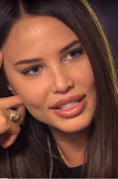 Instagram vs реальность: звезды с&nbsp;&laquo;щечками&raquo;, нашедшие ракурс для&nbsp;точеных скул