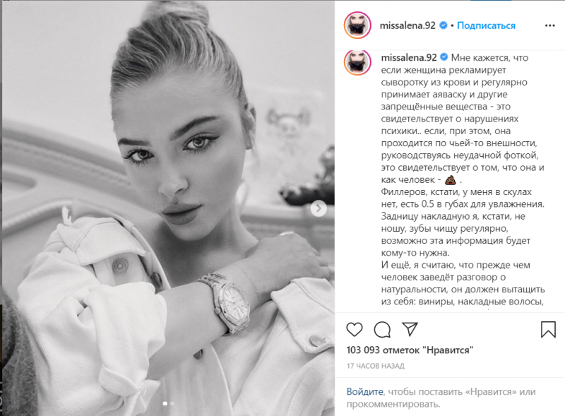 &laquo;В свои 27 будете с раздутым лицом и неестественной мимикой&raquo;: Виктория Боня прокомментировала внешность Алены Шишковой, модель ответила 