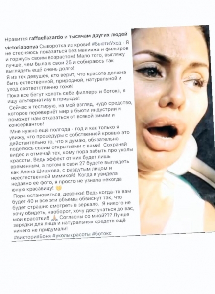 &laquo;В свои 27 будете с раздутым лицом и неестественной мимикой&raquo;: Виктория Боня прокомментировала внешность Алены Шишковой, модель ответила 